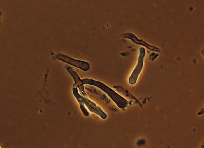 Crosta bianca da det. (Byssomerulius corium)